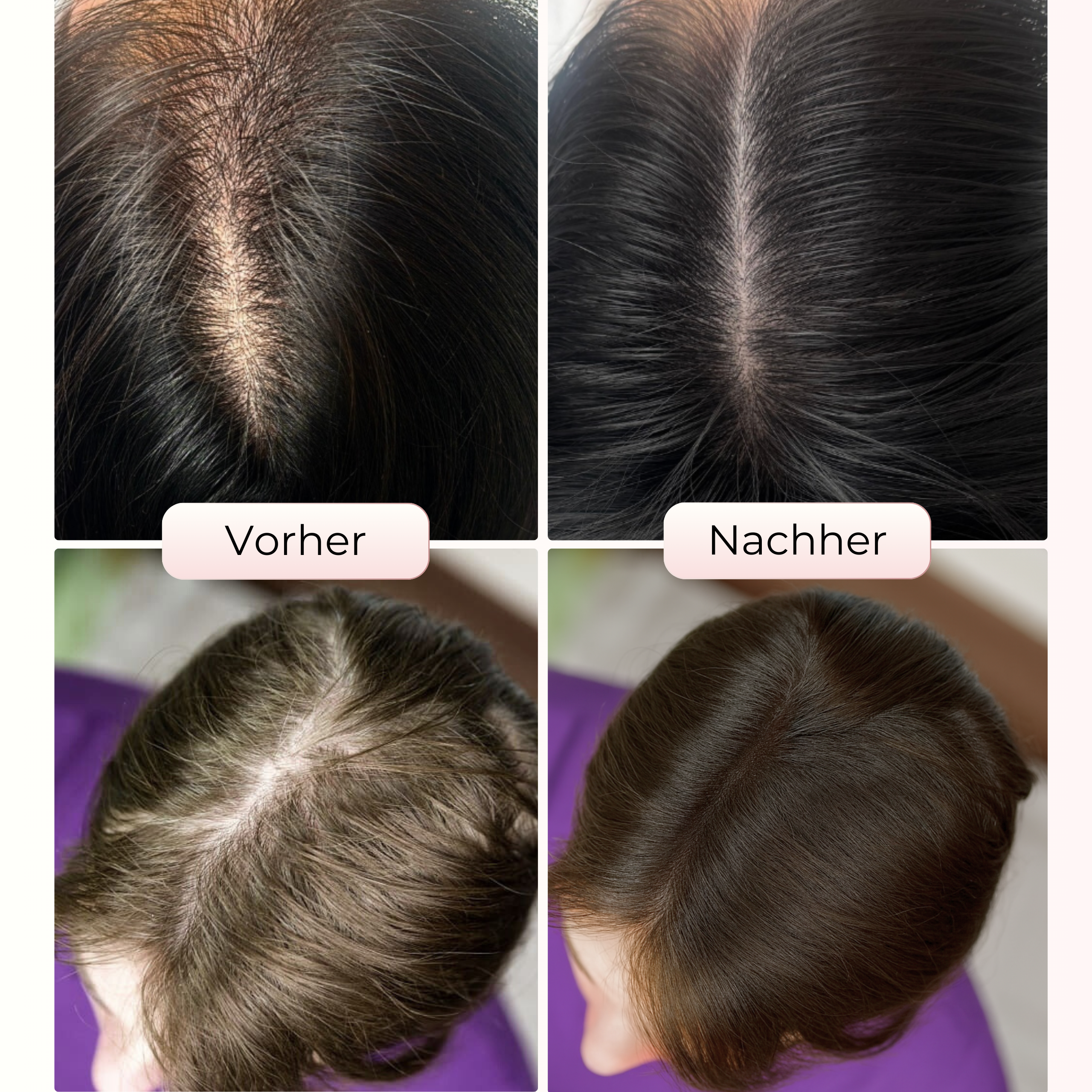 TrueShade™ – Kaschiert lichte Stellen sofort - für 7 Tage natürlich volleres Haar
