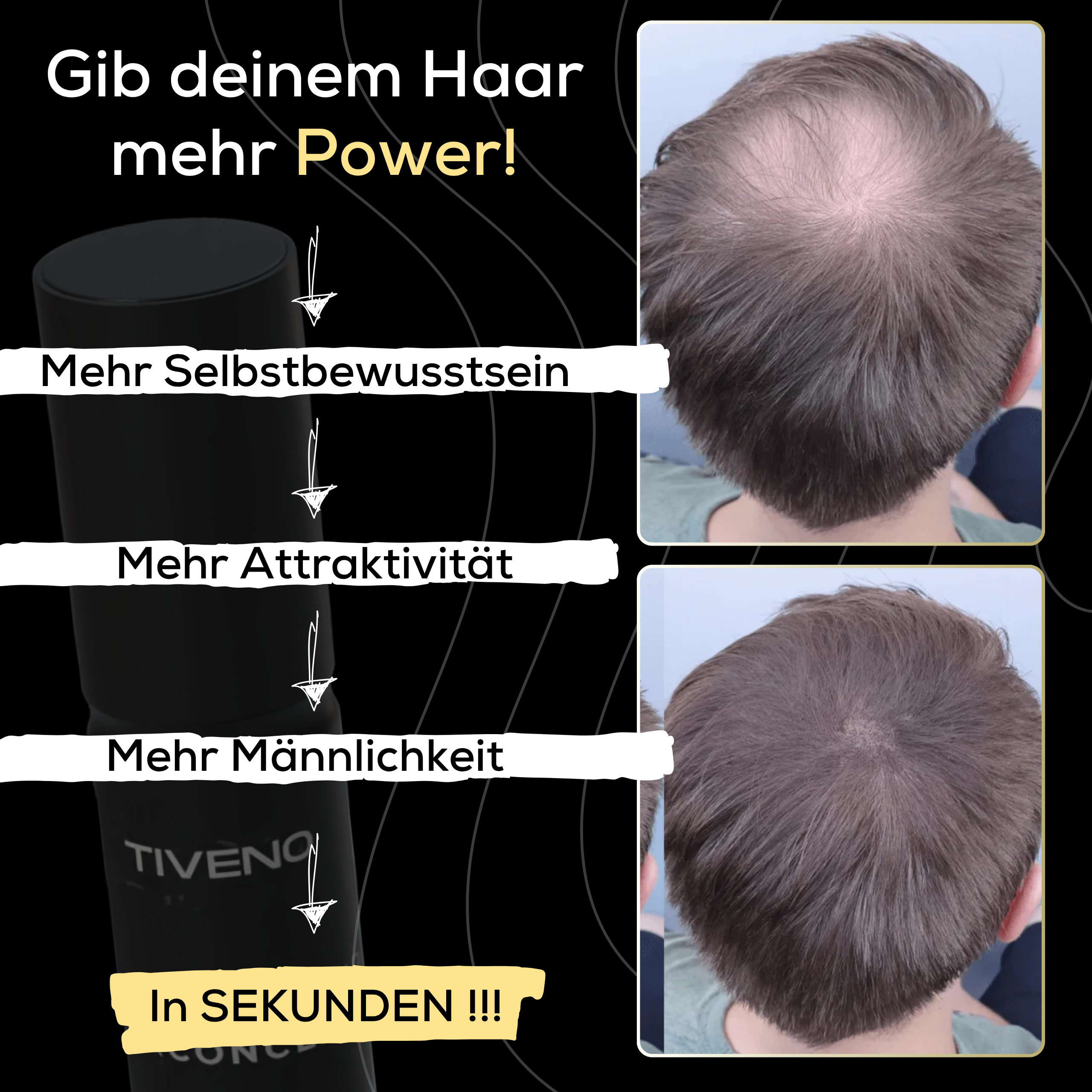 TrueShade™ - Färbt Kopfhaut unauffällig für dichtes & selbstbewusstes Haar bis zu 7 Tage