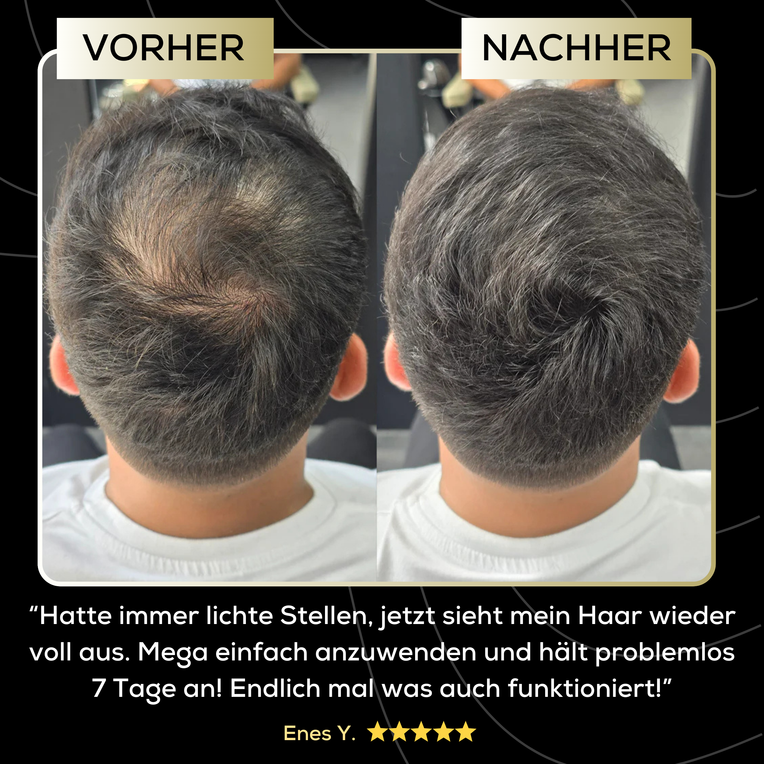 Magiccolour™ - Kaschiert Haarausfall unauffällig & natürlich für 7 Tage