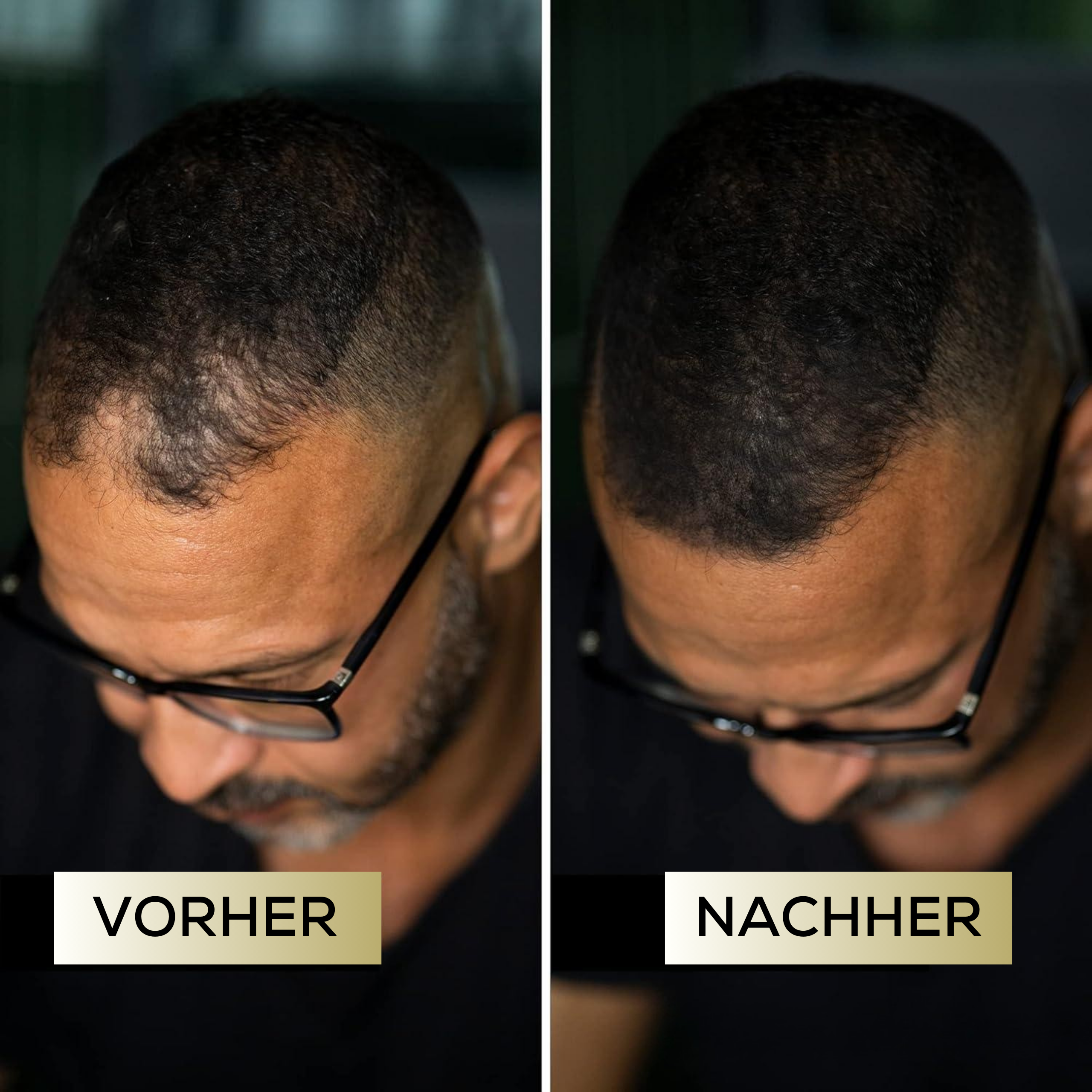 Magiccolour™ - Färbt Kopfhaut unauffällig für dichtes & selbstbewusstes Haar
