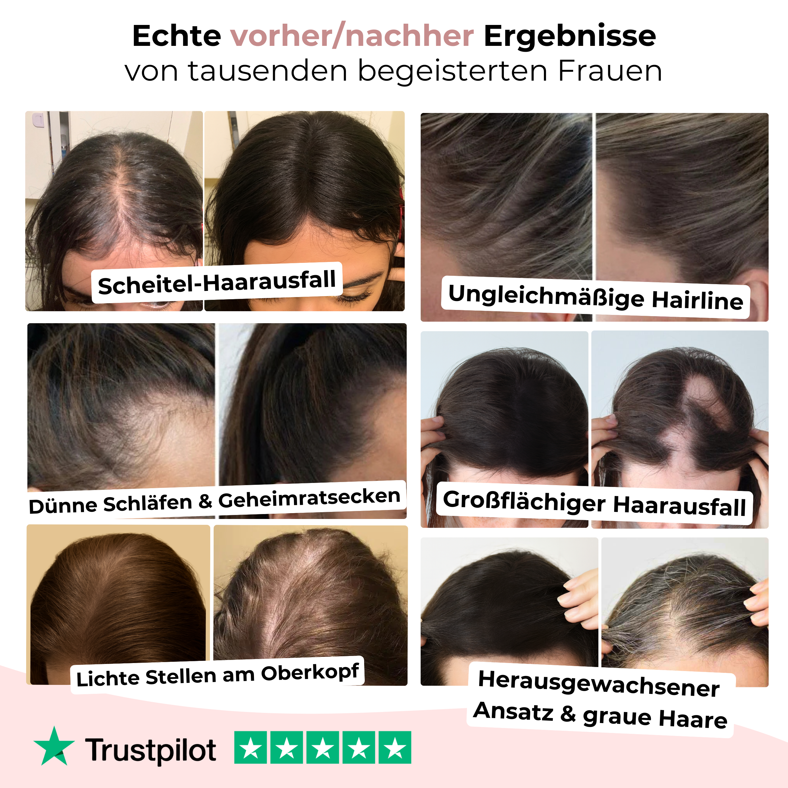TrueShade™ – Kaschiert lichte Stellen sofort - für 7 Tage natürlich volleres Haar