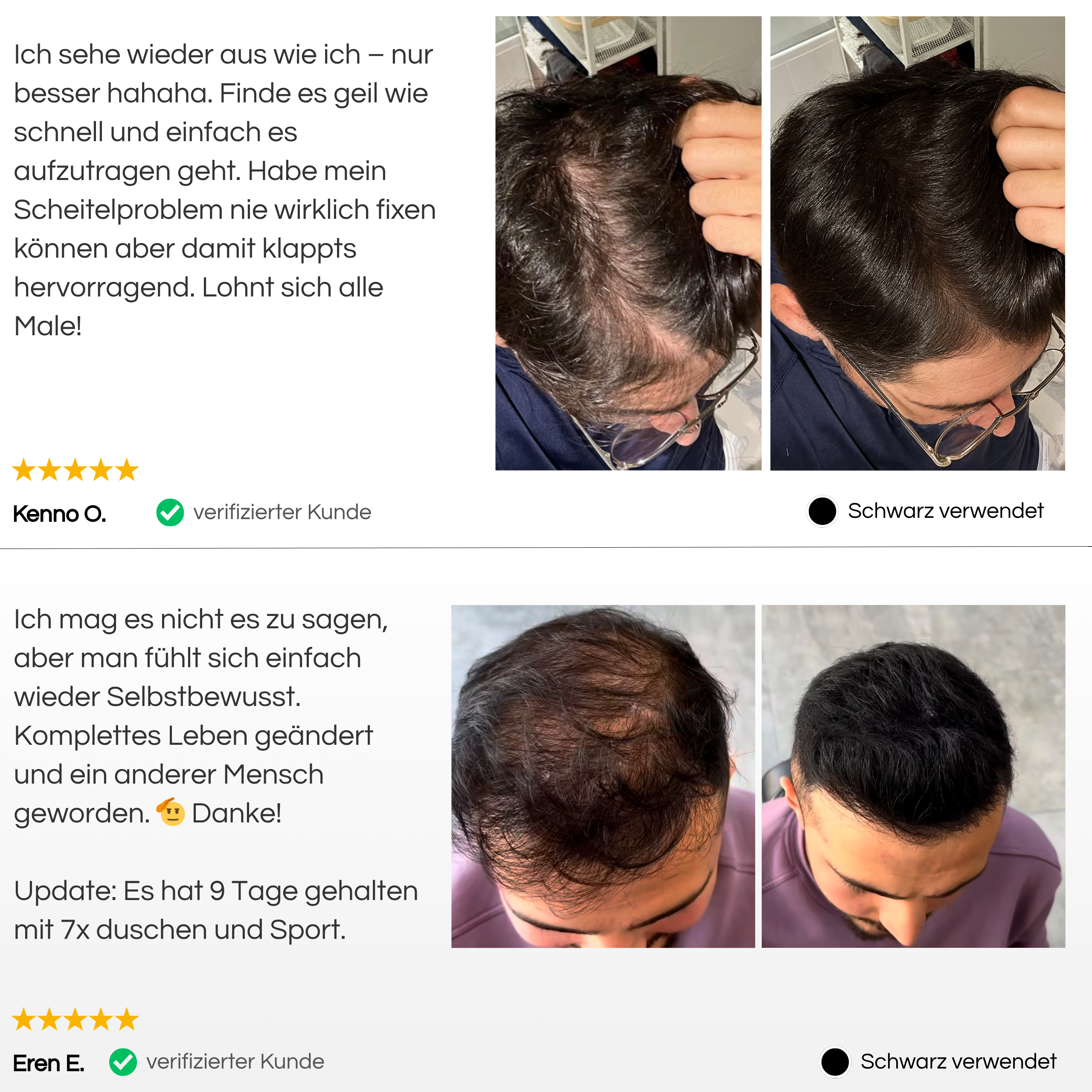 TrueShade™ - Kaschiert Haarausfall für 7 Tage am Stück. Natürlich & unsichtbar.