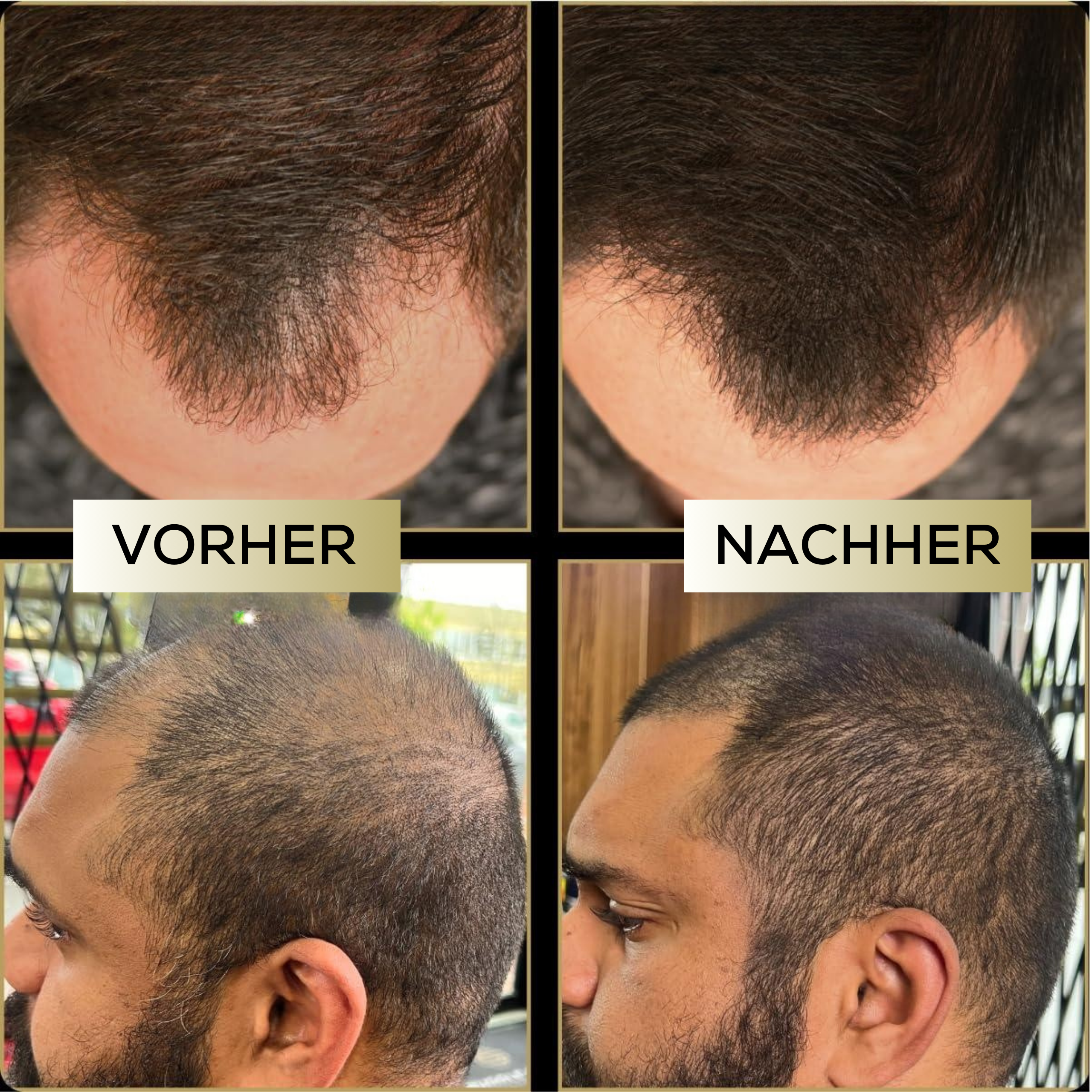 Magiccolour™ -  Färbt Kopfhaut unauffällig für dichtes & selbstbewusstes Haar